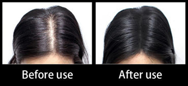 Hair Building Fibre Fibers refill bag Hair Thickening Keratin 10g 50g 100g